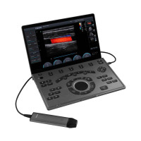 CHISON SonoAir 30 – ultralengvas nešiojamas echoskopas