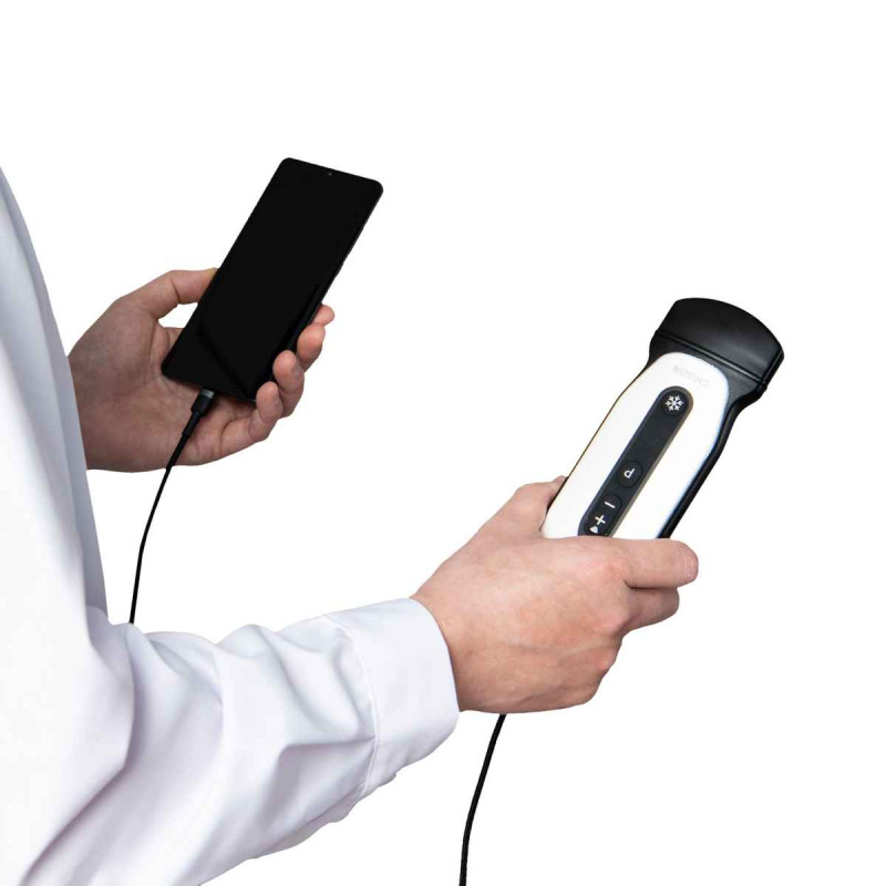 Chison nešiojamas ultragarso aparatas „SonoEye“ P1-P6